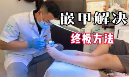 甲沟炎视频,视频解析病因、症状及治疗全攻略